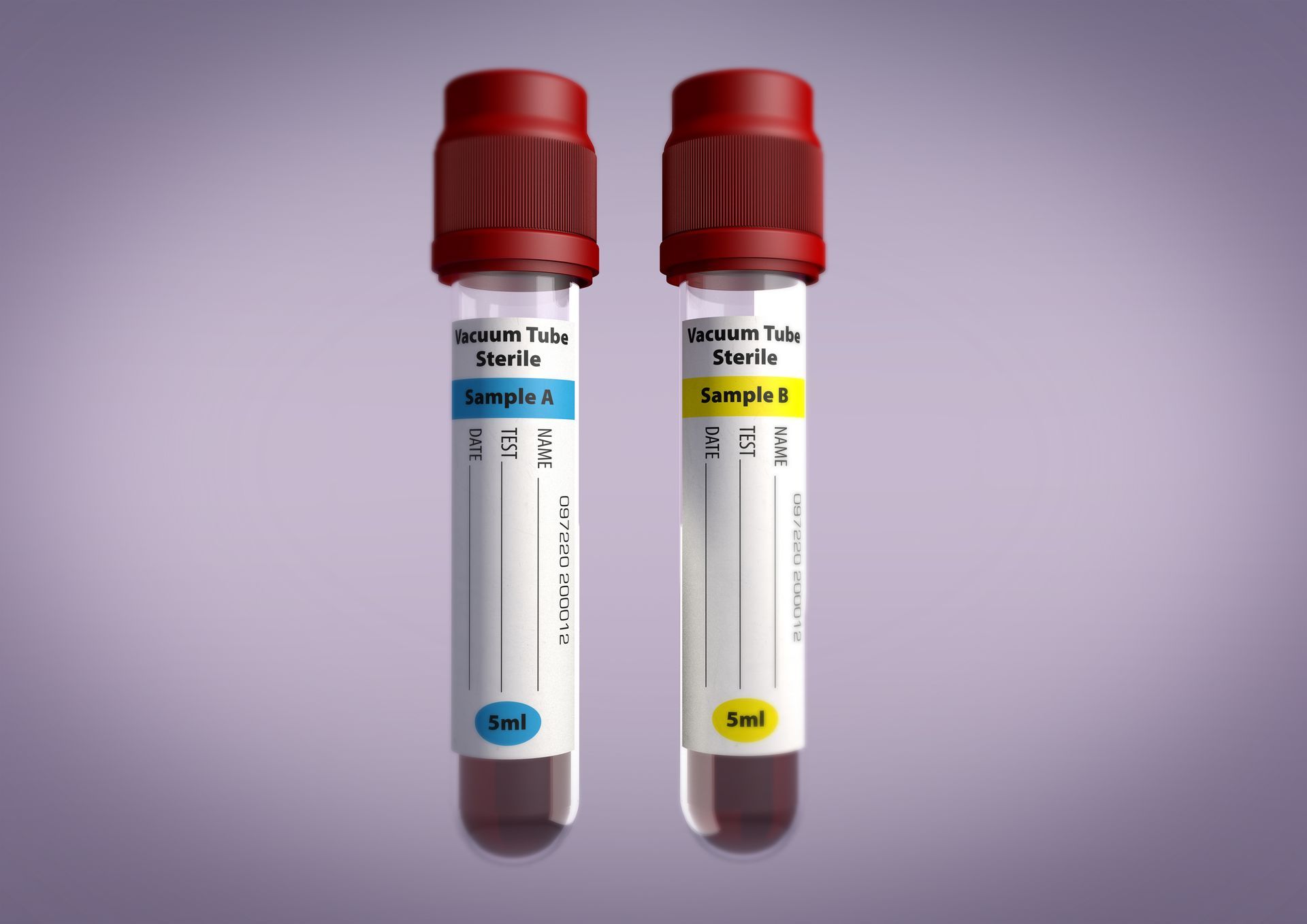Two blood collection tubes with red caps and labels; one blue, one yellow, filled with blood.