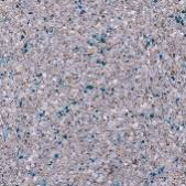 Close-up view of a textured surface with a speckled pattern, dominated by shades of gray with small blue and darker specks.