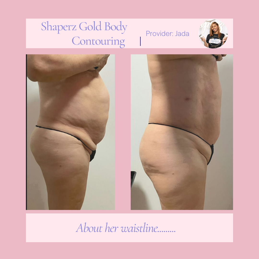 A before and after picture of a woman 's waistline.