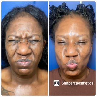 A before and after photo of a woman 's face