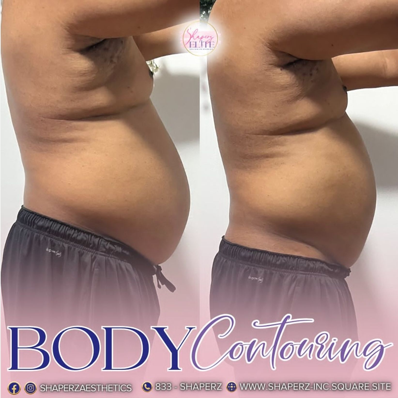 A man 's stomach is shown before and after a body contouring treatment.
