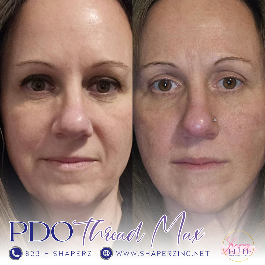 A before and after photo of a woman 's face