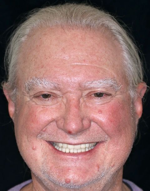 A close up of an older man 's face with a smile on his face.