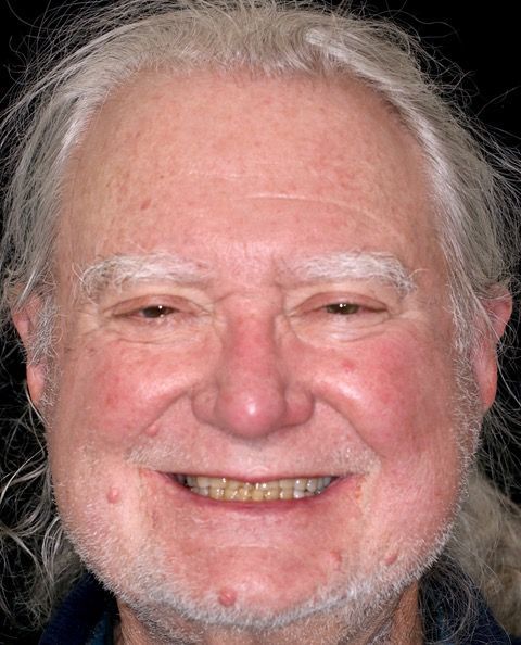 A close up of an older man 's face with a beard smiling.