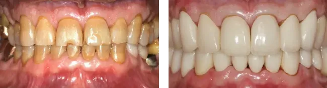 Montgomery Street Dental Before & After
