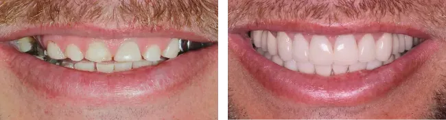 Montgomery Street Dental Before & After