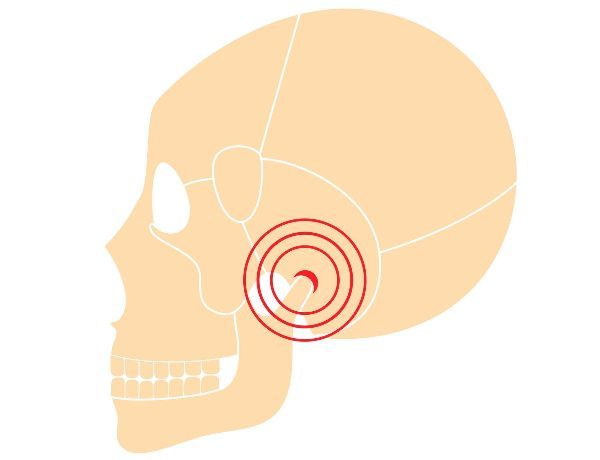 tmj treatment