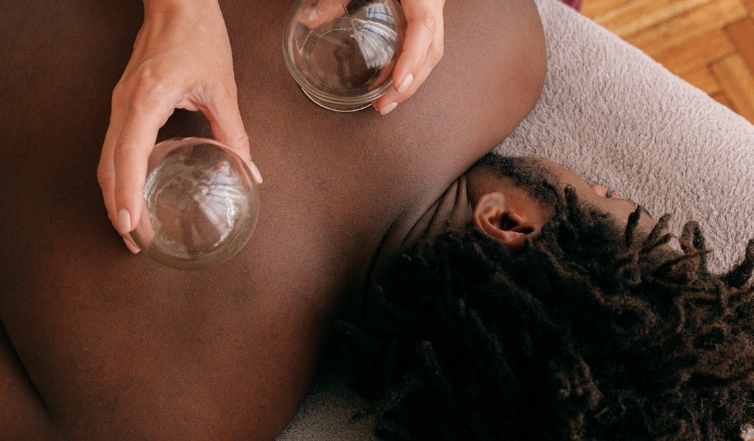 A woman is getting a cupping treatment on her back.