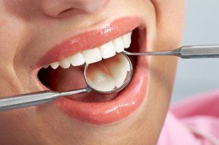 Teeth cleanings—Woman having Regular Check up in Sacramento, CA