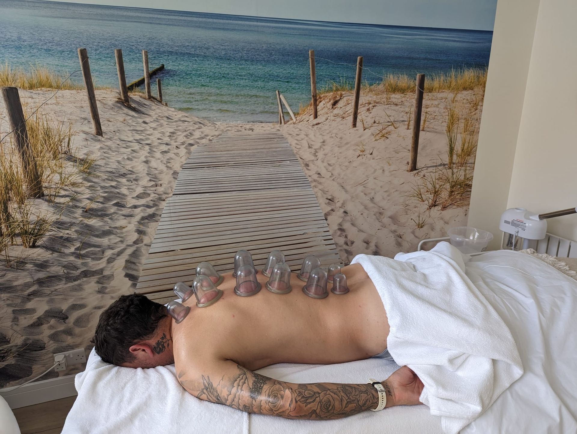 Man receiving cupping therapy on his back, lying on a massage table. Glass cups are attached.