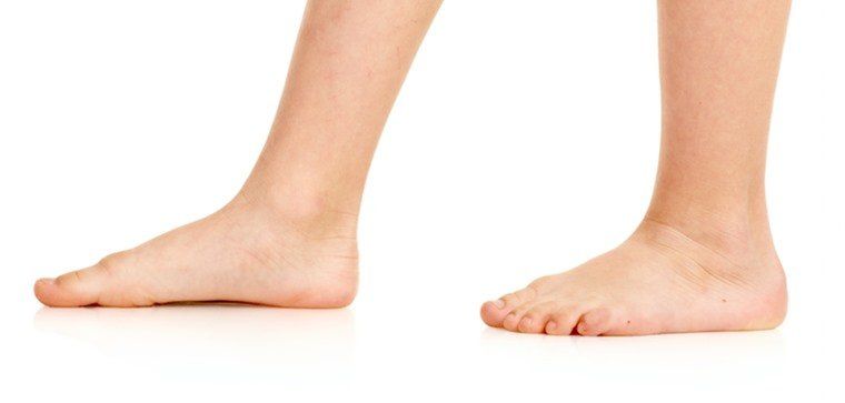 Bare Feet — Durham, NC — Central Carolina Foot And Ankle Associates