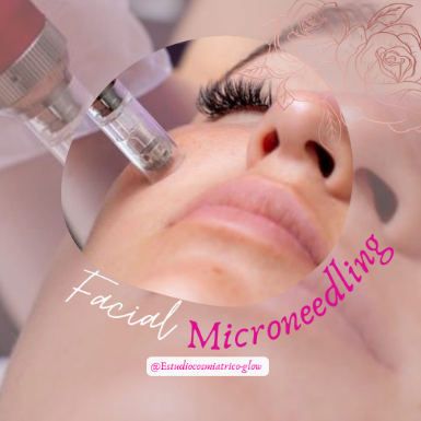 Facial Microneedling