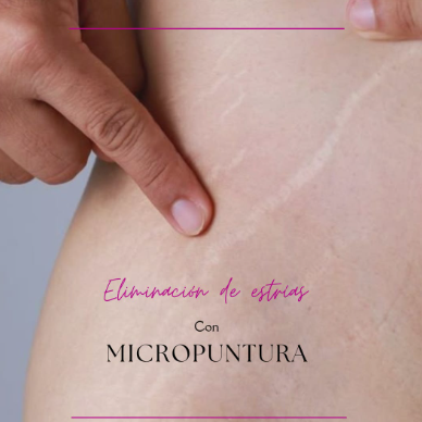 Micropuntura