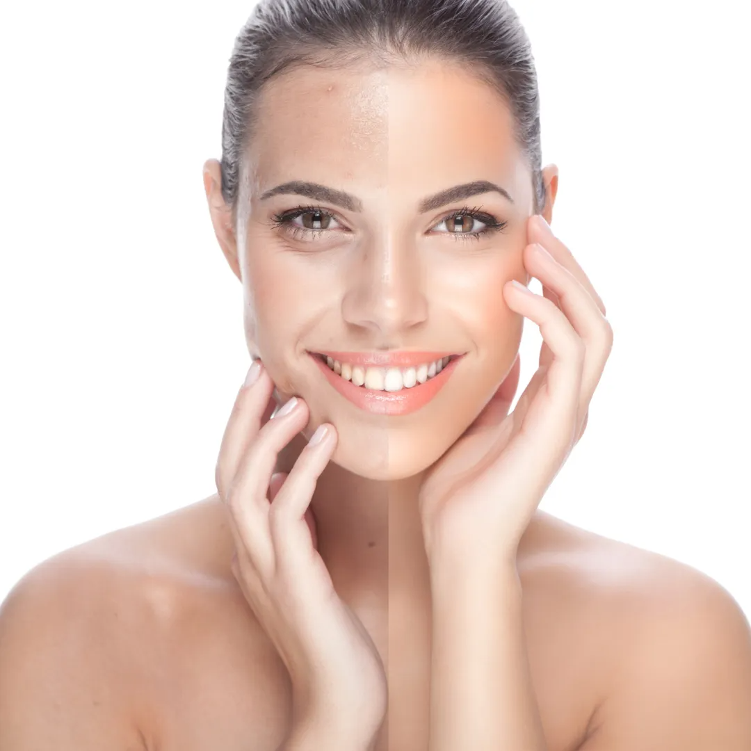Woman smiling with hands on face
