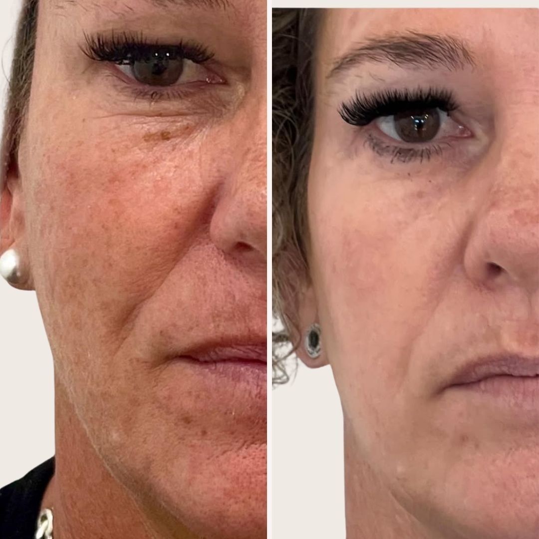 Woman holding hands up to face with pale pink nails