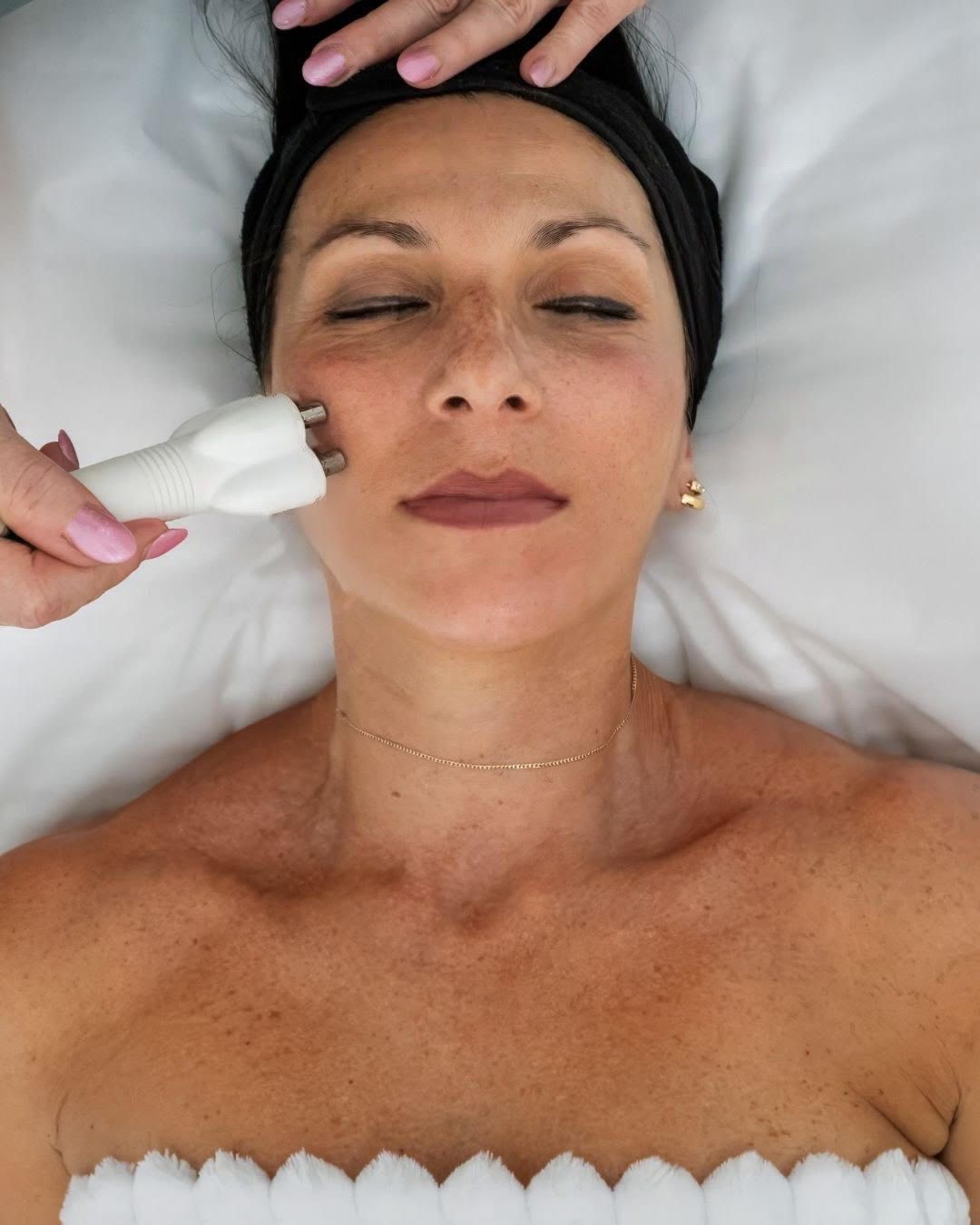 Woman receiving RF Skin treatment
