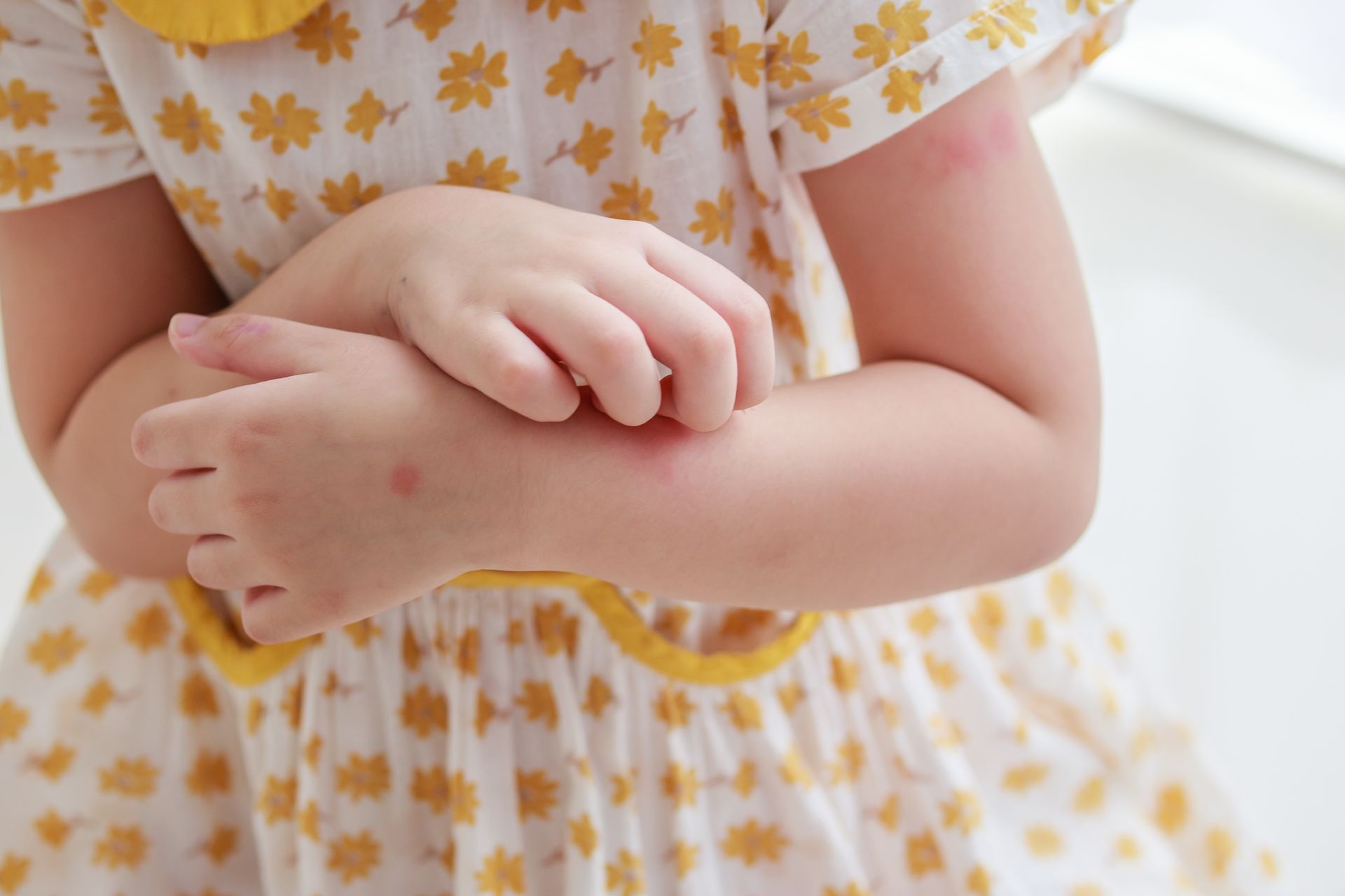 A little girl in a yellow dress is scratching her arm.