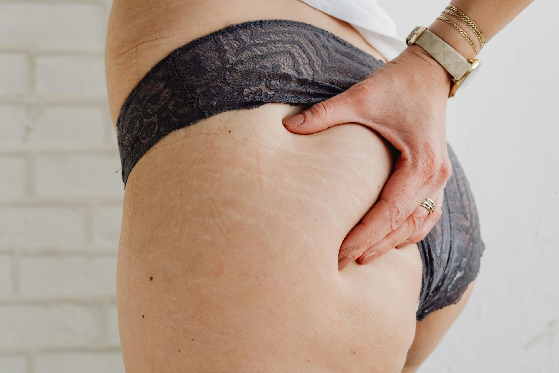 Close-up of a hand pinching the skin at the hip while wearing dark lace underwear and bracelets