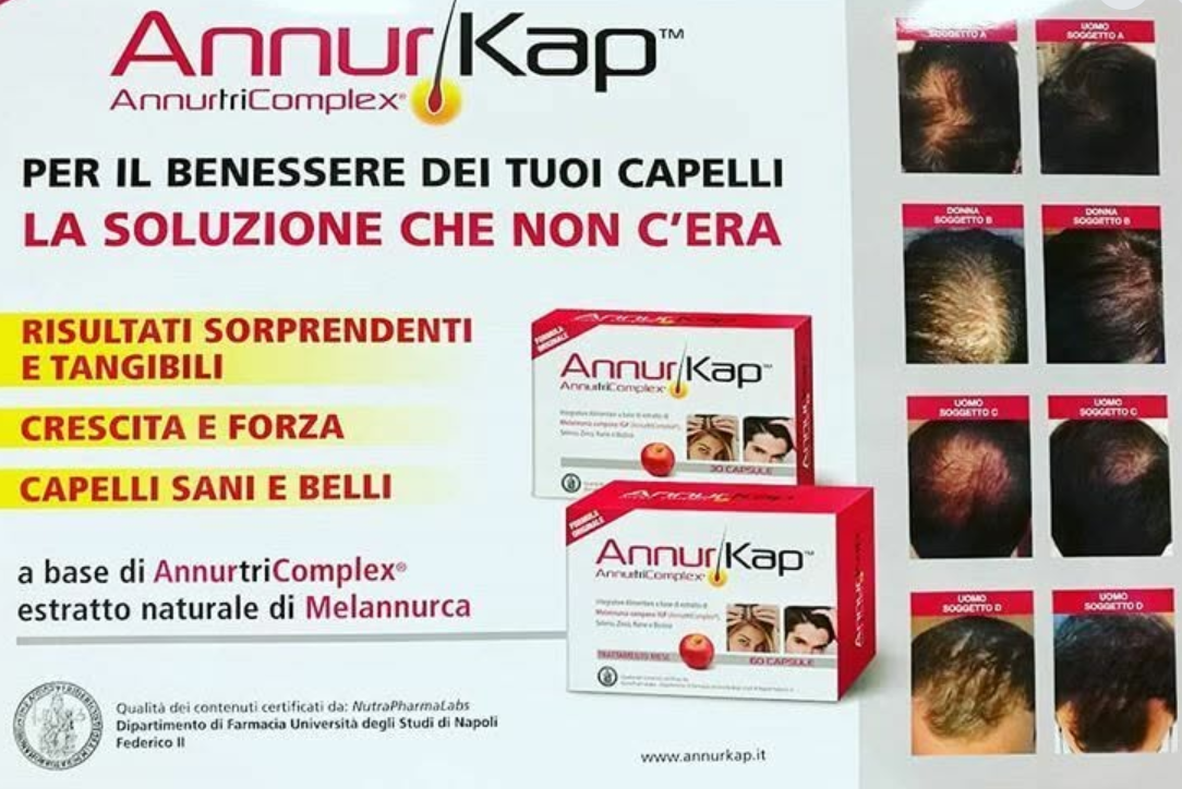 Pubblicità dell'integratore per capelli AnnurKap con confezione del prodotto, testo in italiano e foto del prima e dopo.