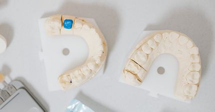 A close up of a model of a person 's teeth on a white background.