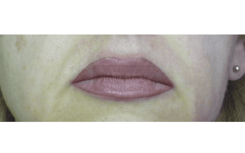 Labbra dopo lavoro di  ricostruzione labbra con sfumatura effetto riempimento ( Lavoro appena eseguito )