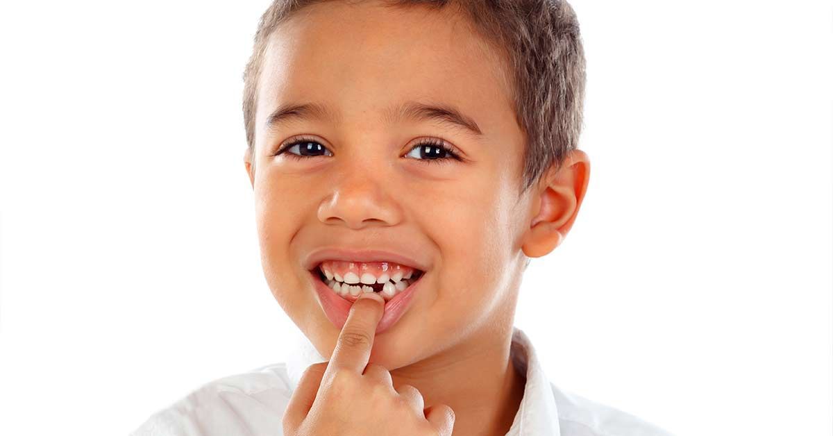 Dentes de leite: cuidados essenciais que o pediatra pode orientar