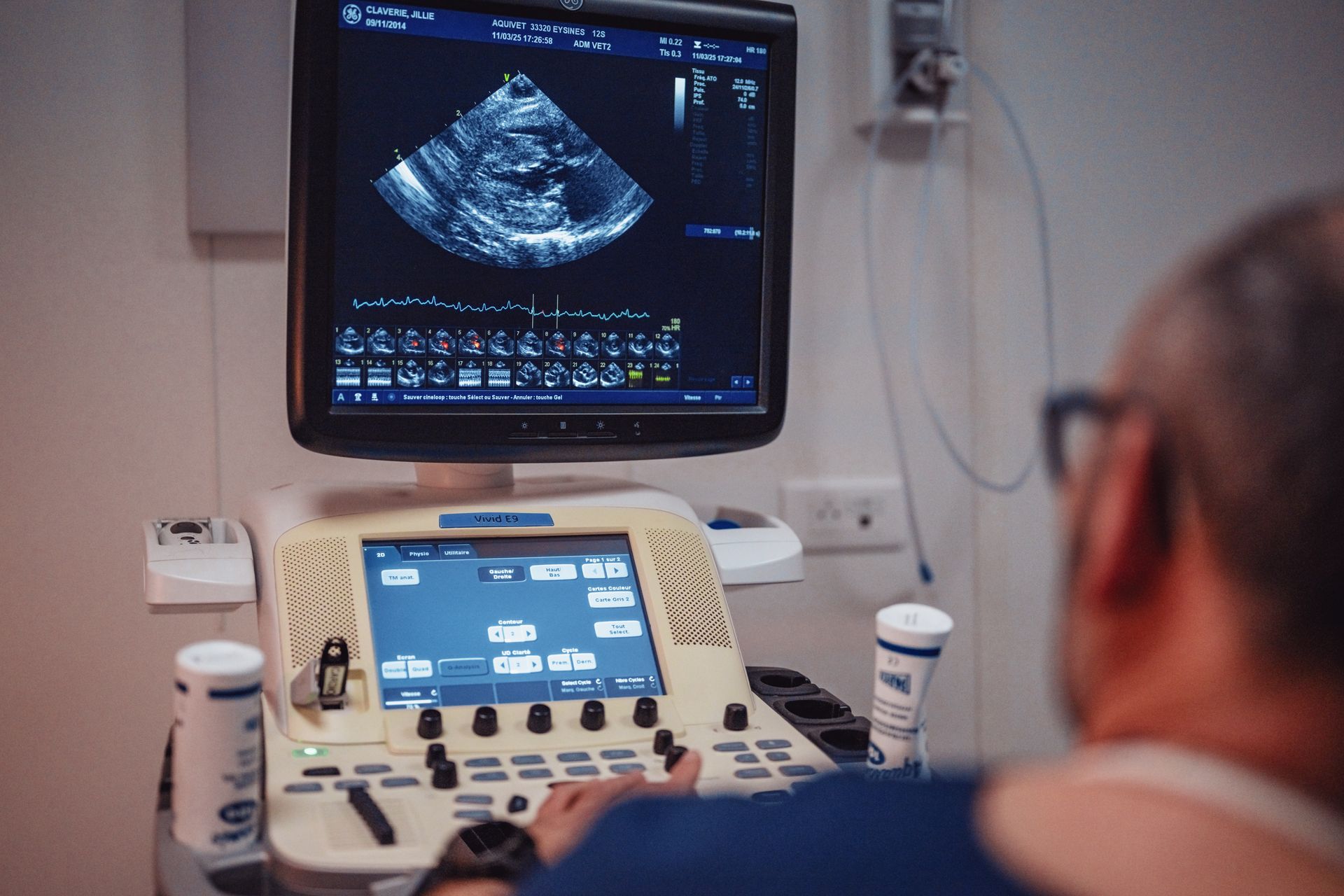 Un homme regarde un appareil à ultrasons dans un hôpital.