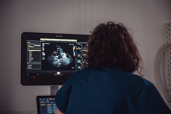 Une femme regarde une échographie sur un écran d'ordinateur.