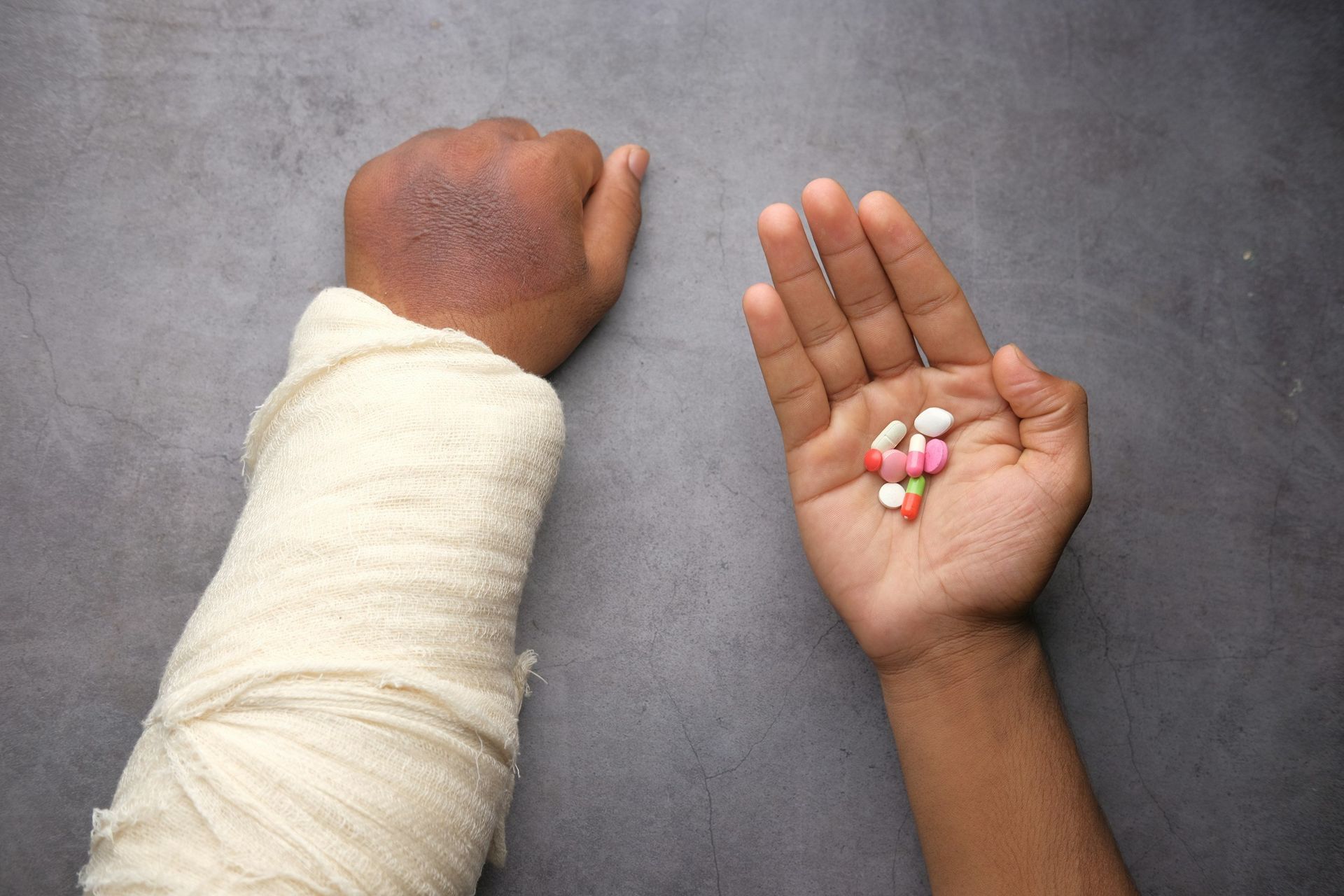 A person with a cast on their arm is holding a handful of pills.