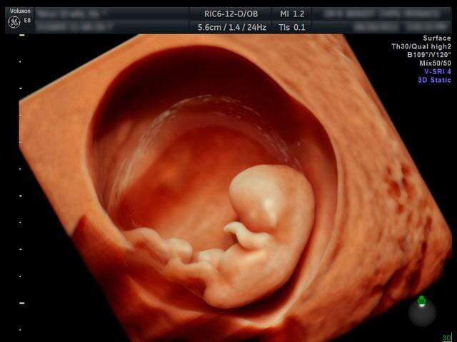 DR. JUAN MANUEL GONZÁLEZ CARRILLO – ULTRASONIDO HD LIVE