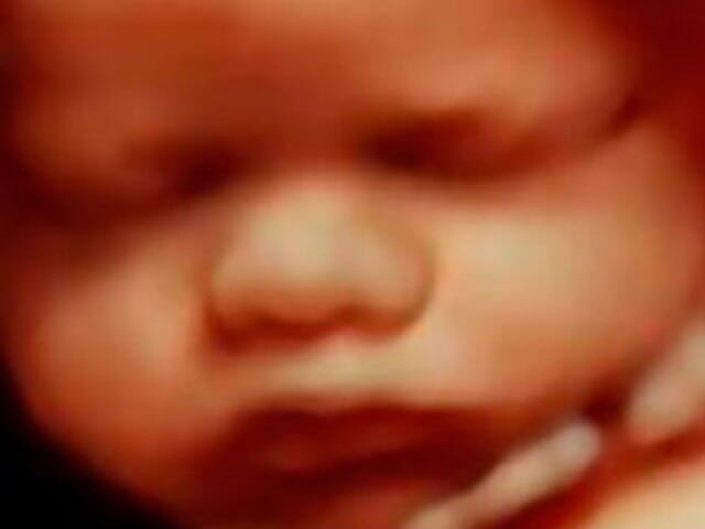 DR. JUAN MANUEL GONZÁLEZ CARRILLO – ULTRASONIDO 2D, 3D, 4D