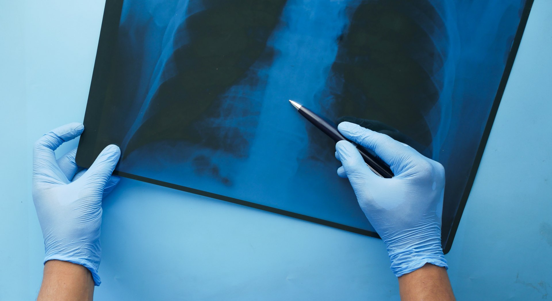 pasadena-personal-injury-case