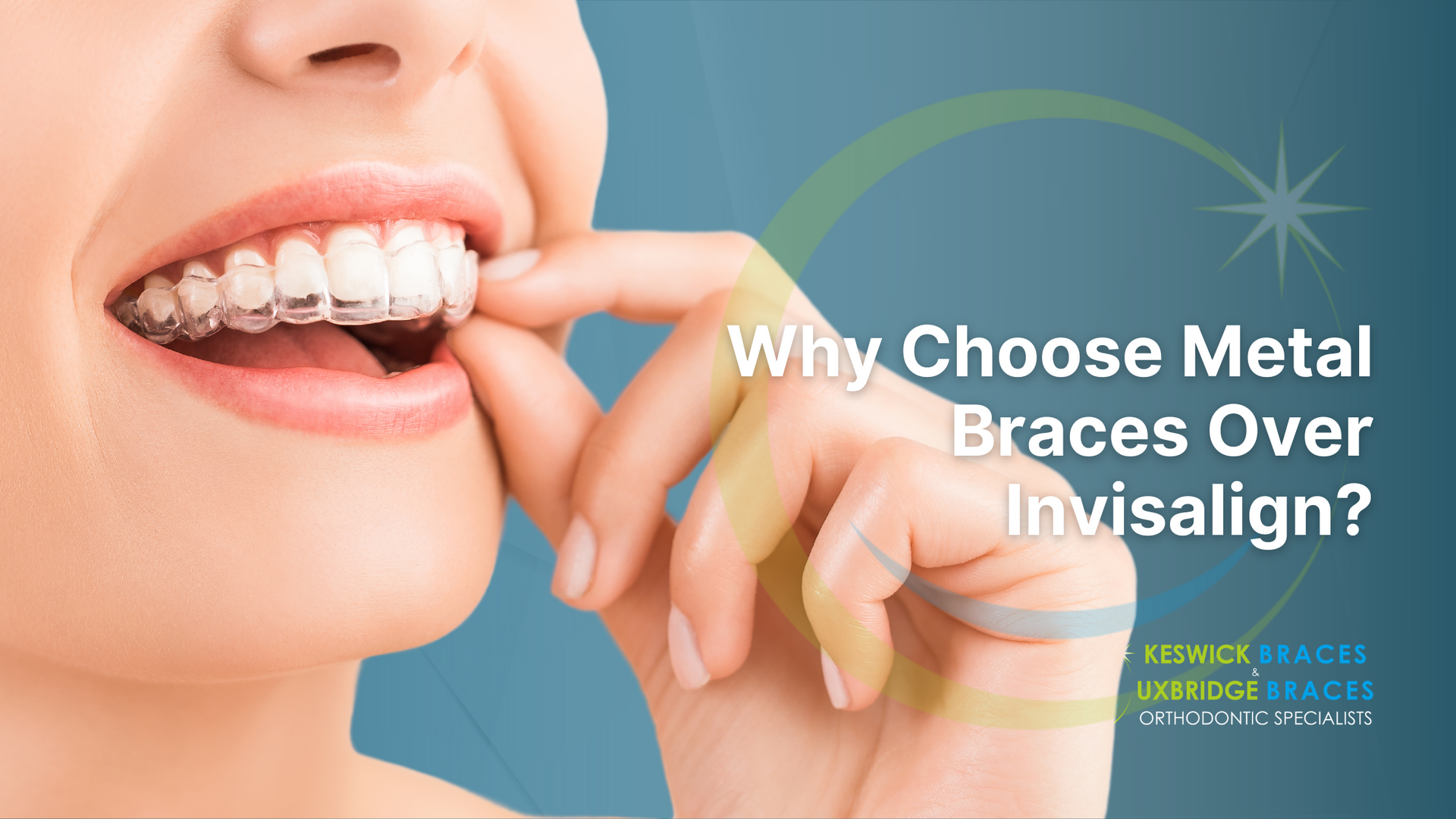 A woman is wearing metal braces over invisalign.