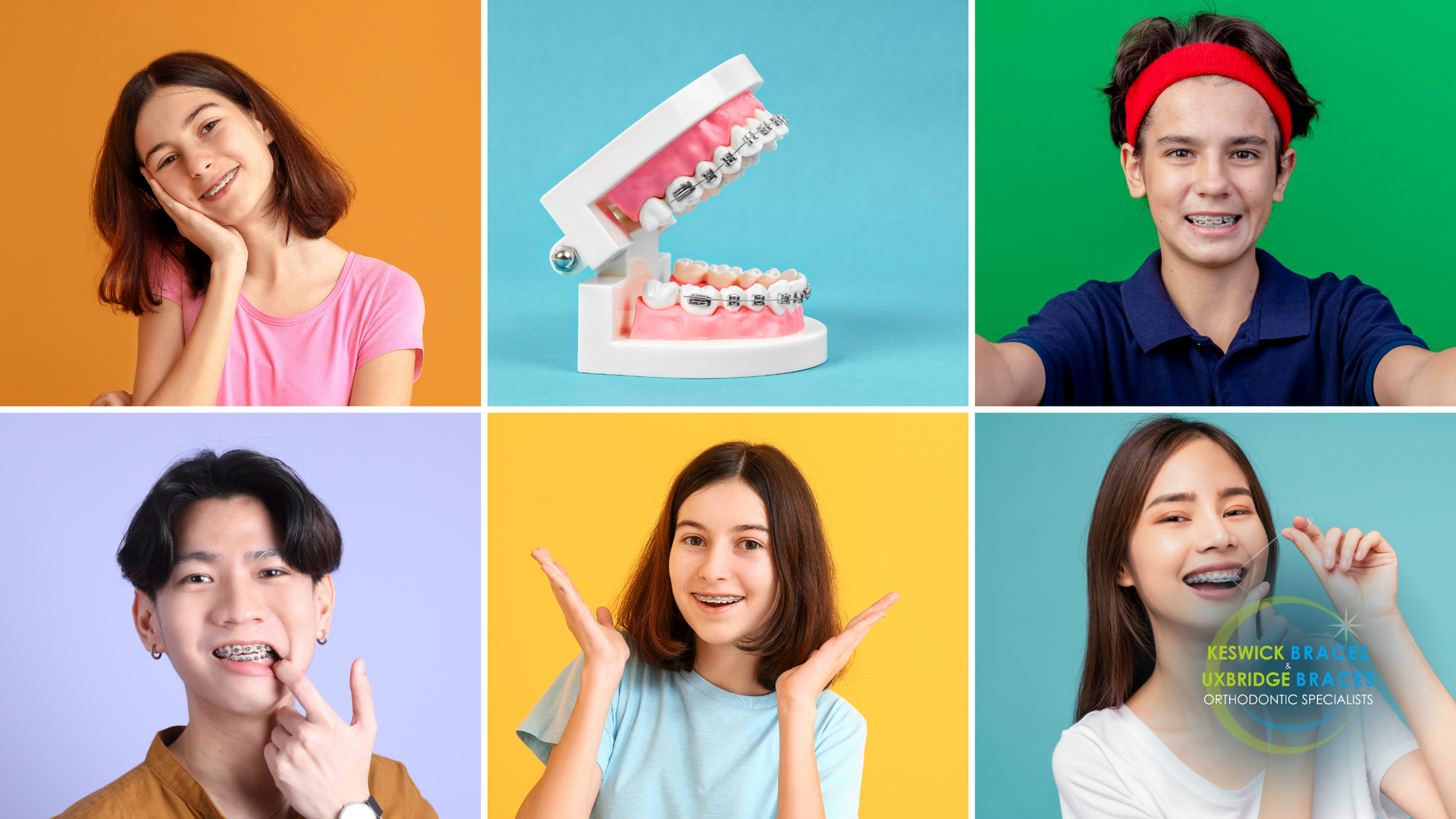 A group of young people with braces on their teeth are posing for a picture.