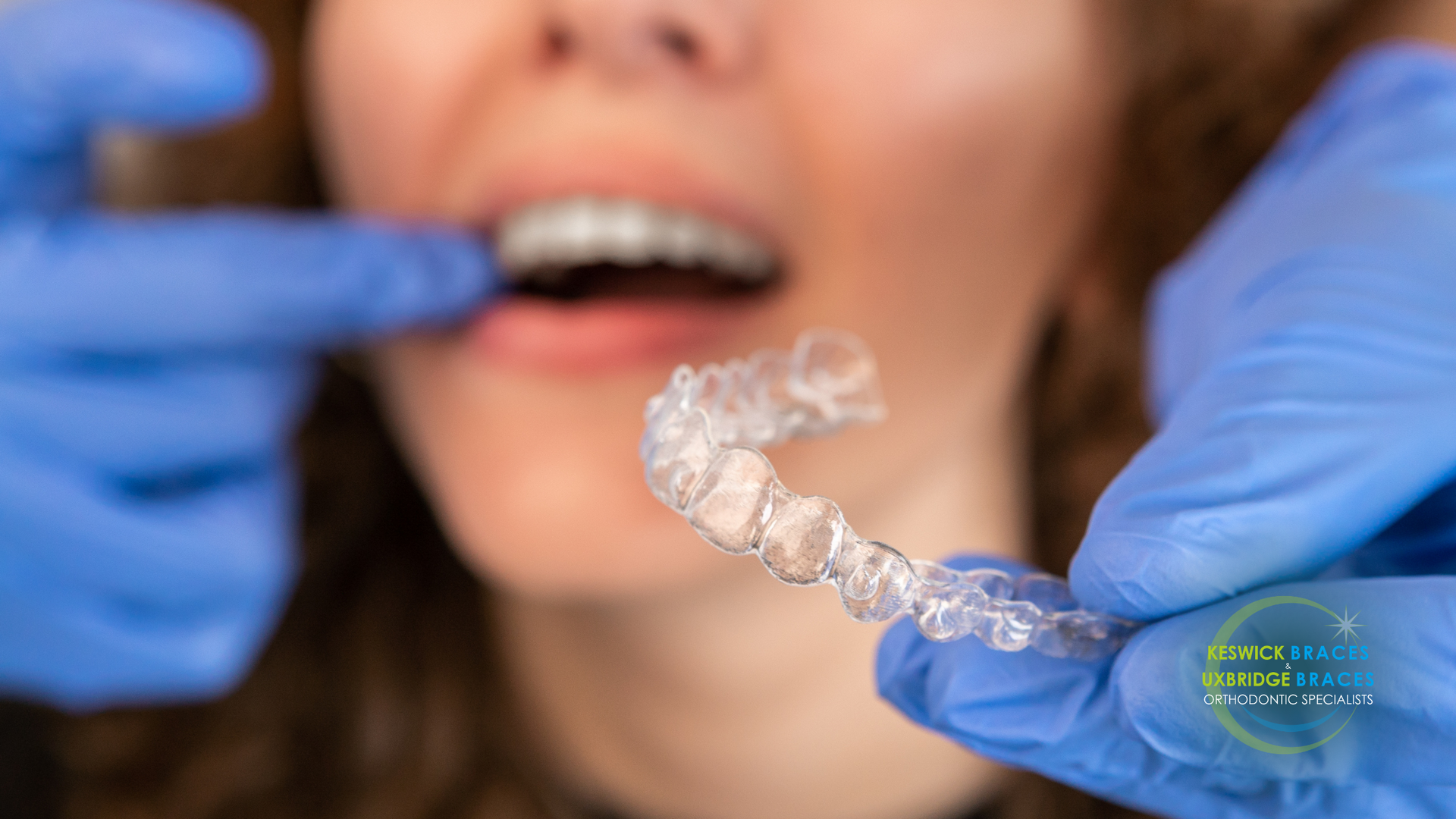 A woman is getting her teeth straightened by a dentist.