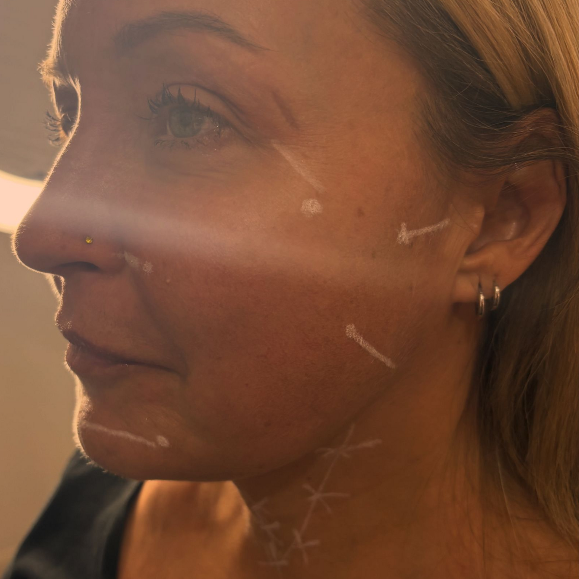 Aesthetics By Luisha | Skin Boosters In Derby, UK