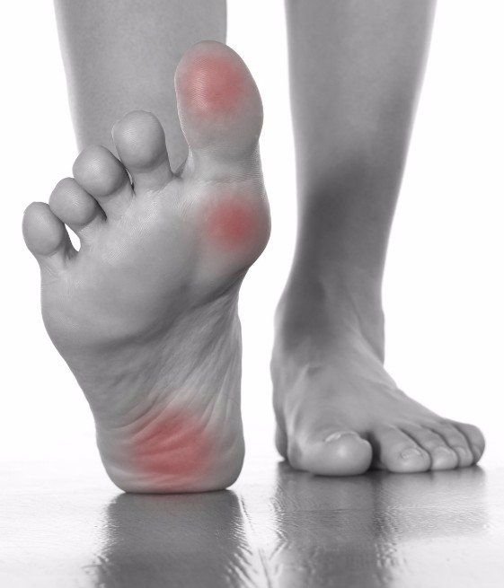 Foot pain points