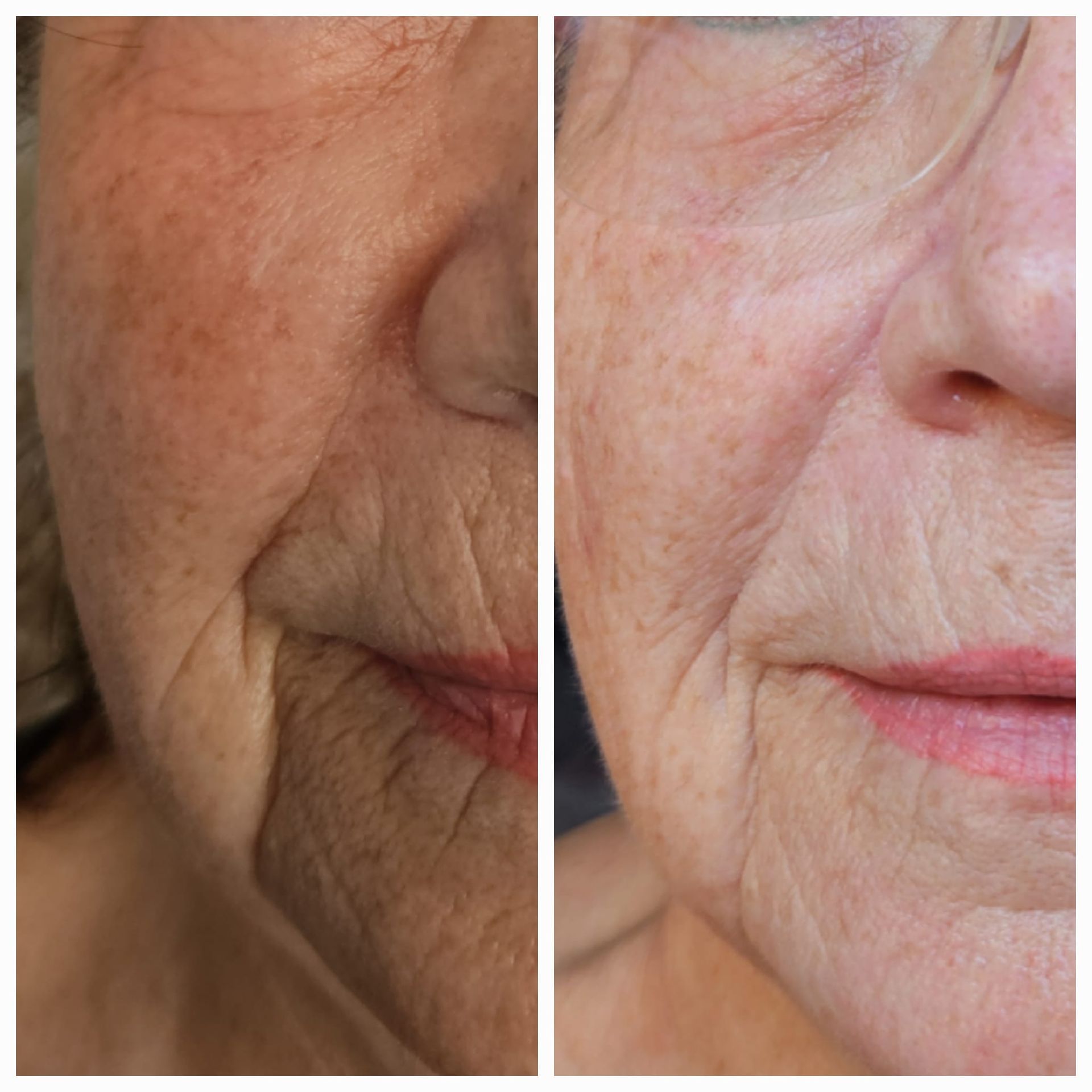 Eine Nahaufnahme des Gesichts einer Frau vor unscharfem Hintergrund.