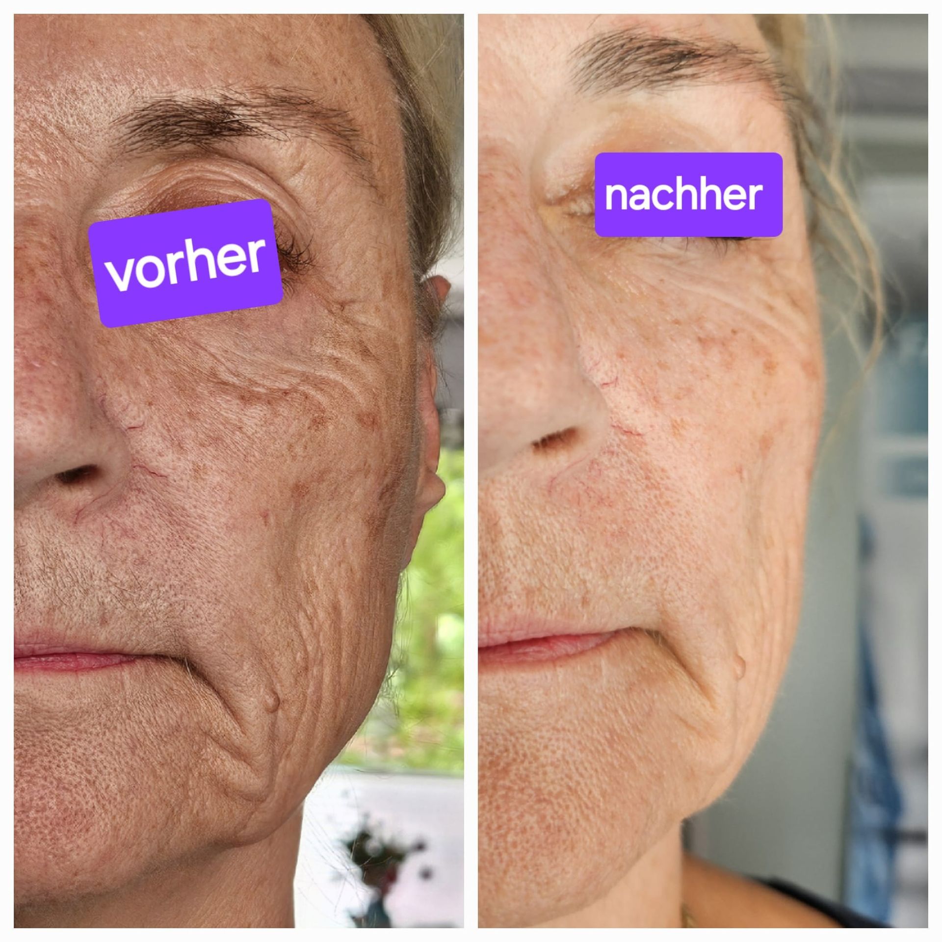 Eine Nahaufnahme des Gesichts einer Frau vor unscharfem Hintergrund.