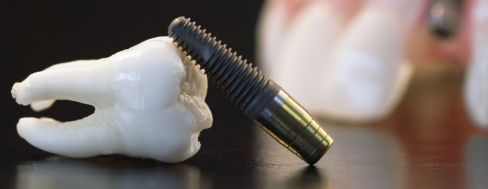 Tooth with dental laboratory tool