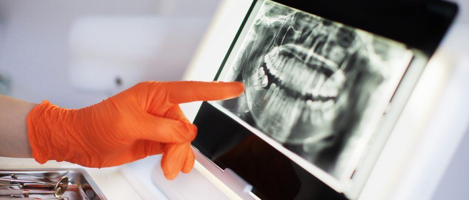 radiografia odontoiatrica
