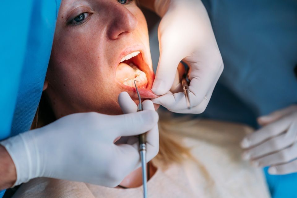 trattamento parodontale