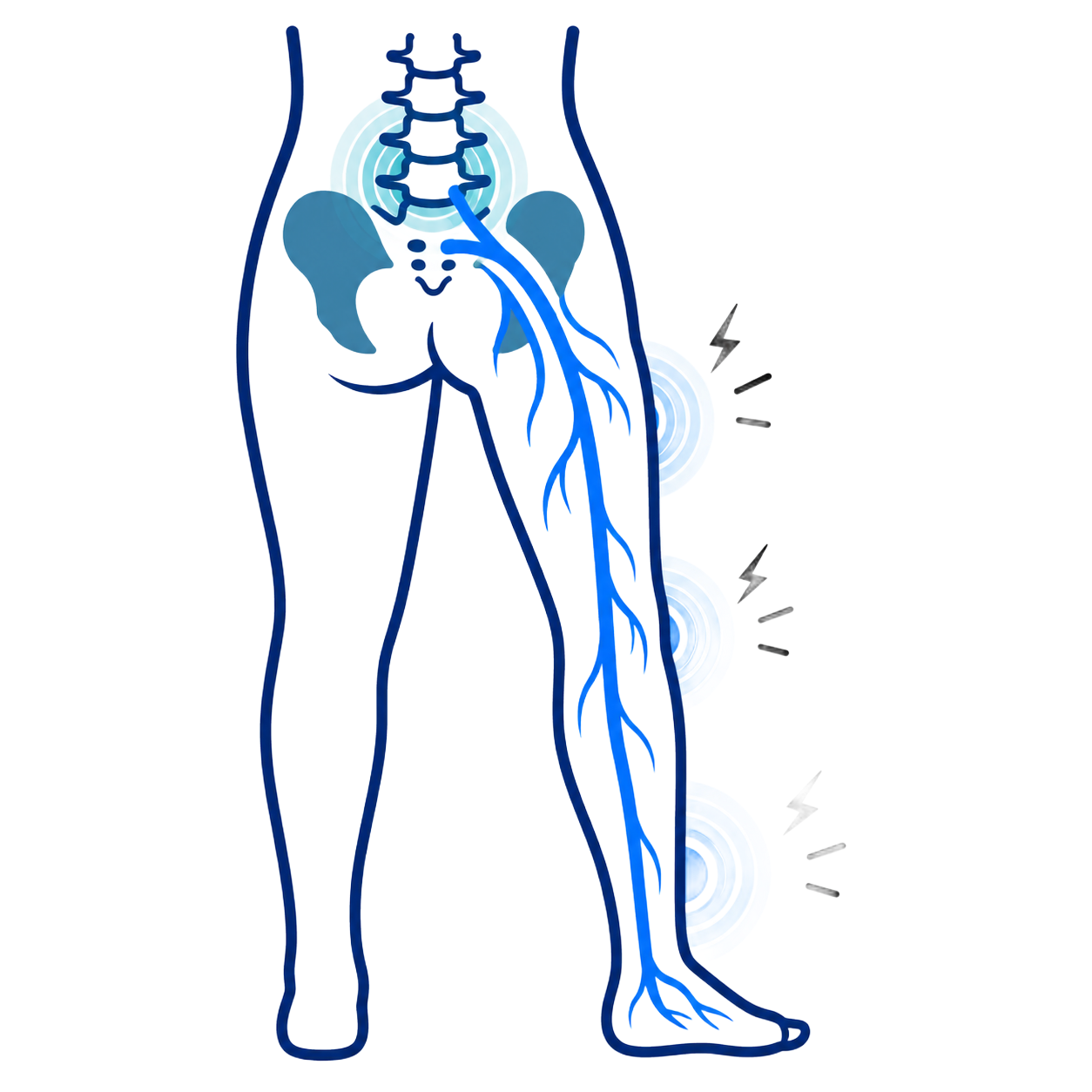Lower body diagram showing sciatic nerve pain from lower back to leg, with blue nerve highlighted.