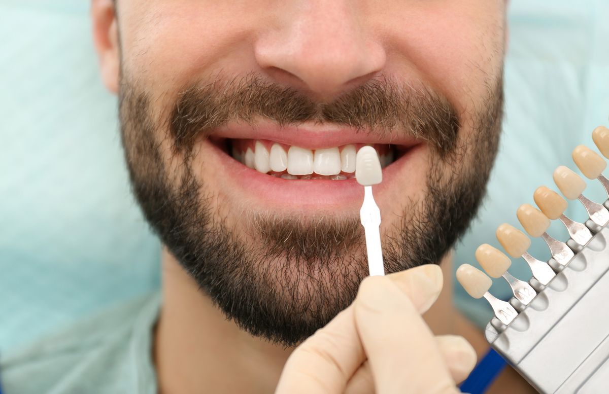 Man smiling while trying dental veneers