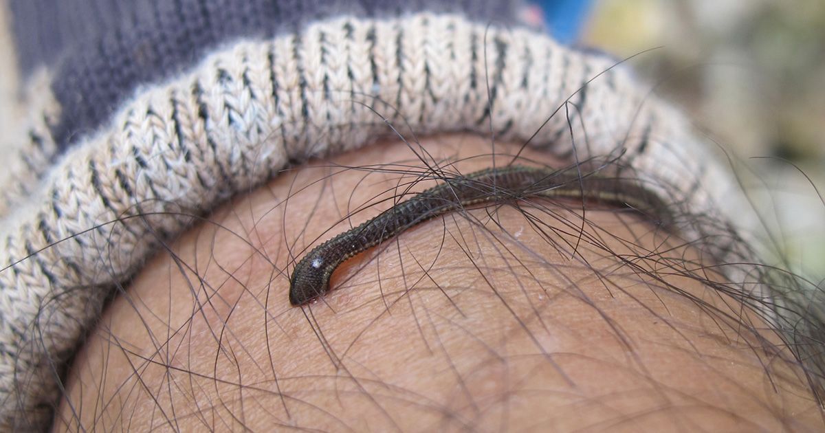 Close-up of a brown leech attached to a human leg with visible hair, next to a knitted sock in an outdoor environment.