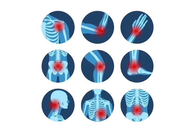 An x-ray of a person 's knee and leg