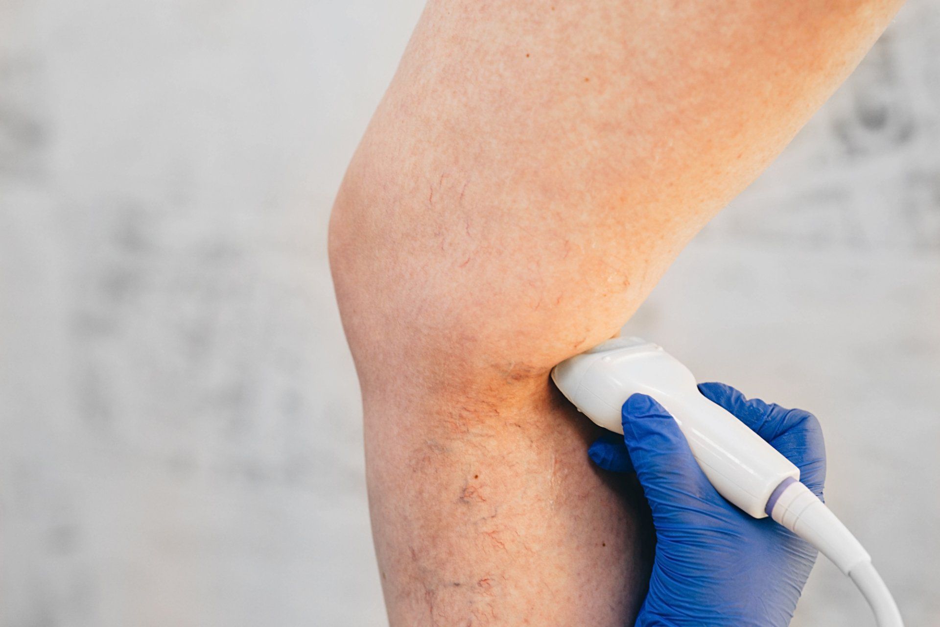 A person is getting an ultrasound on their leg.