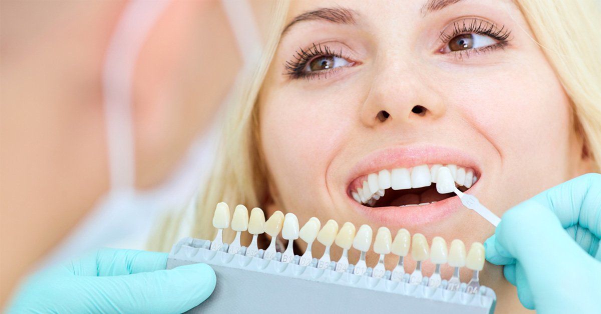 all on four dental implants
