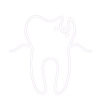 A line drawing of a tooth with a hole in it.