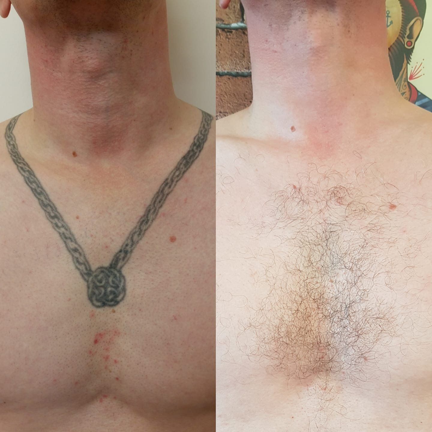 A man has a tattoo on his neck and chest